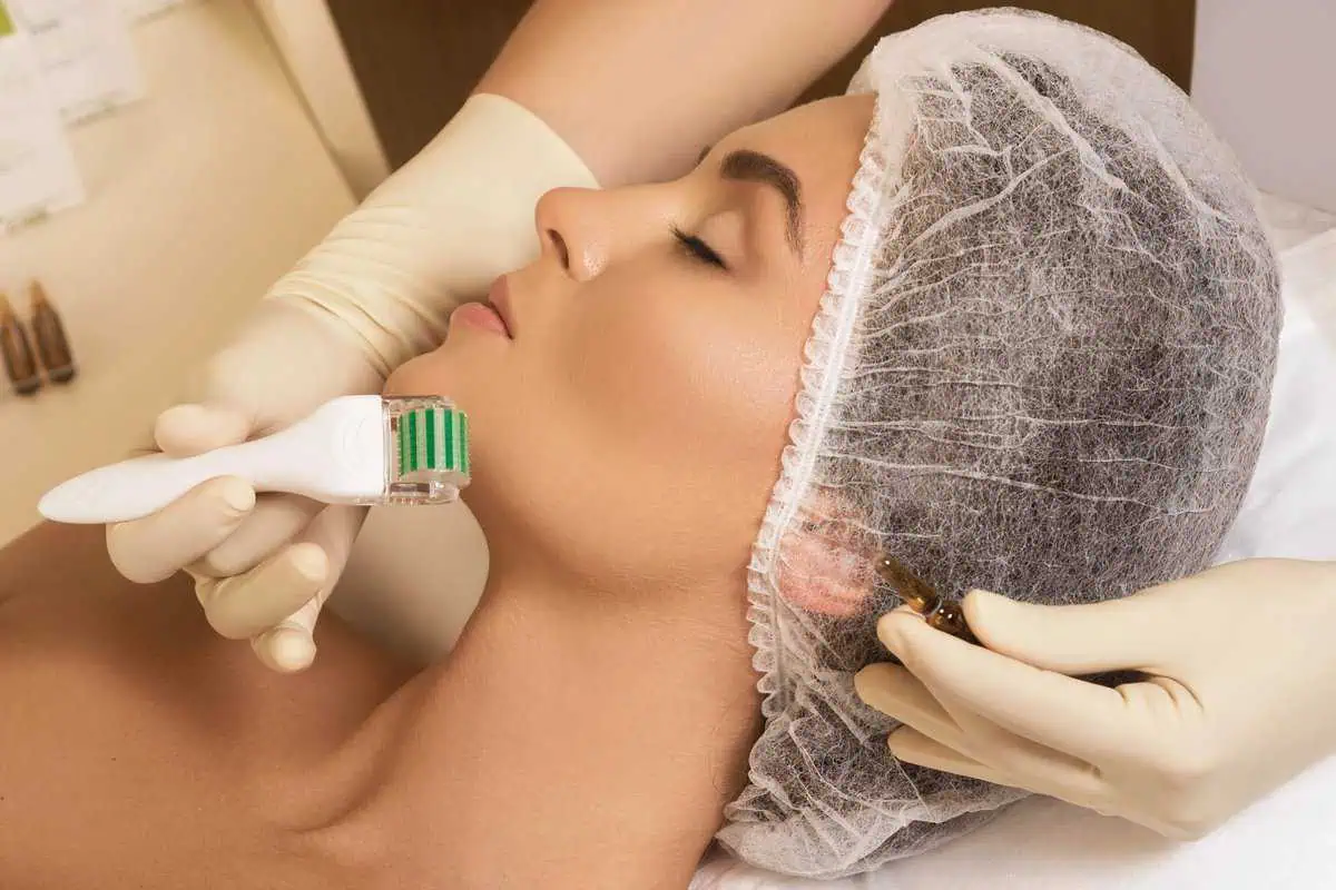 Collagen Stimulation by Youthology Medical in Melville NY