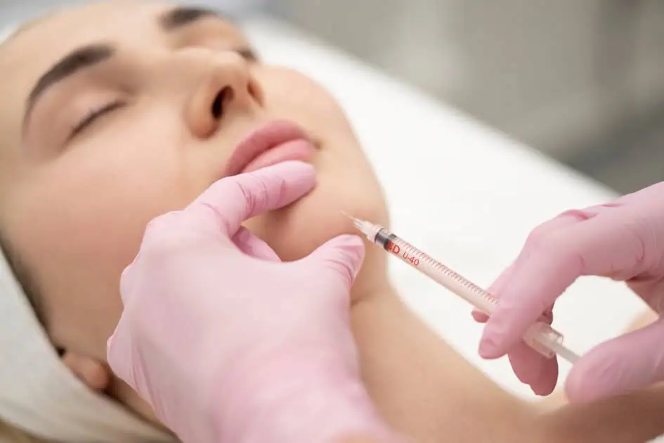Bellafill for Acne Scars by Youthology Medical in Melville, NY