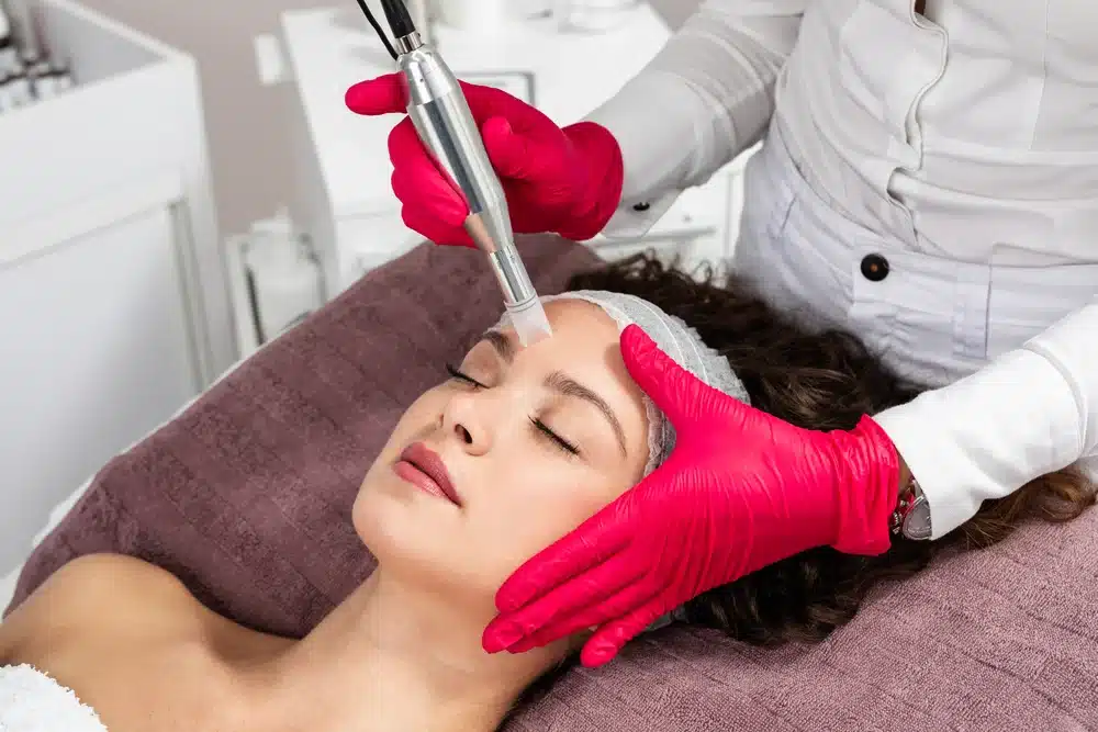 Youthologymedical_Blog_A_Vampire_Facial_With_PRP_In_Melville_NY