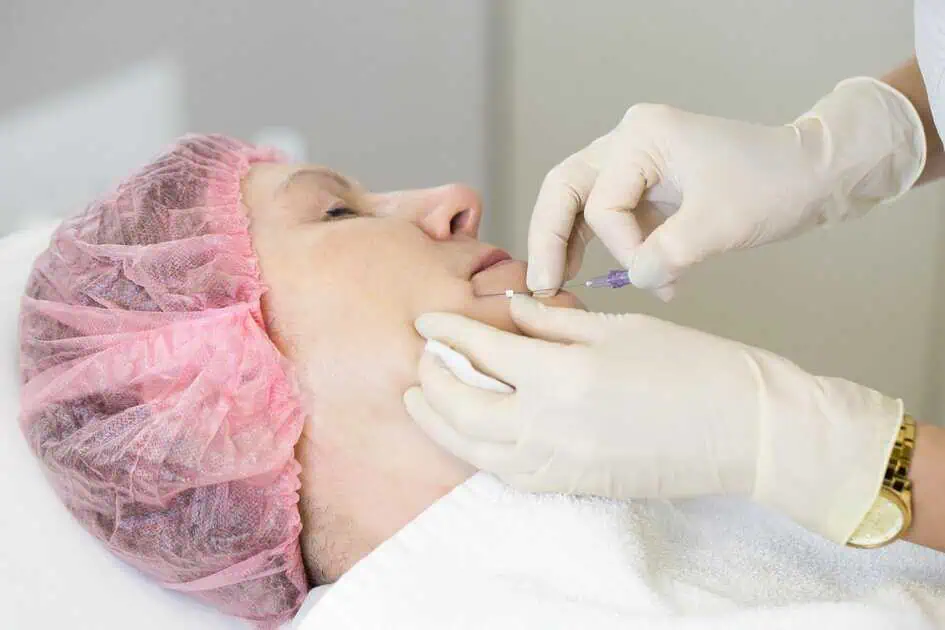 PDO Thread Lifts in Melville, NY by Youthology Medical