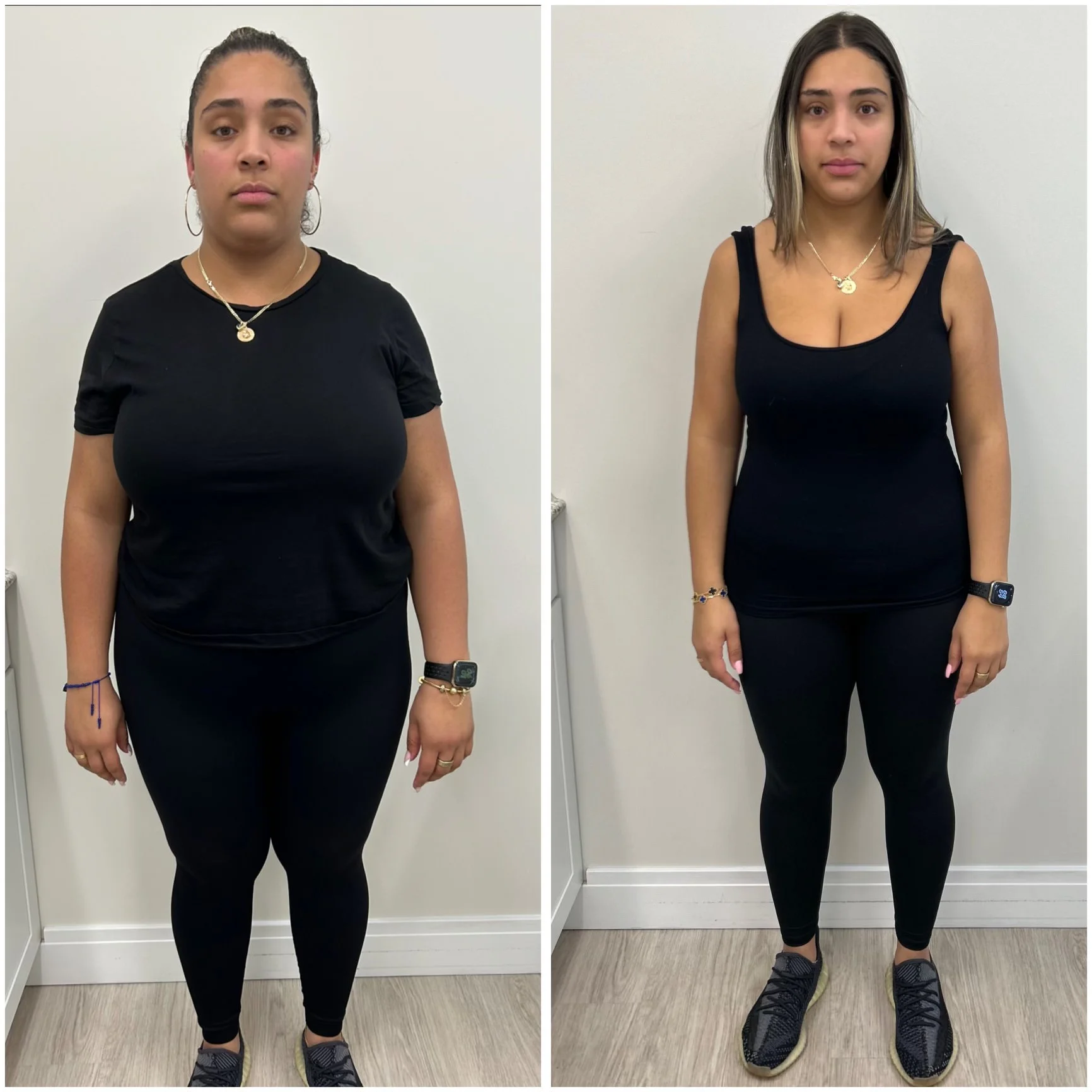 Before and After Image: Weight Management - front