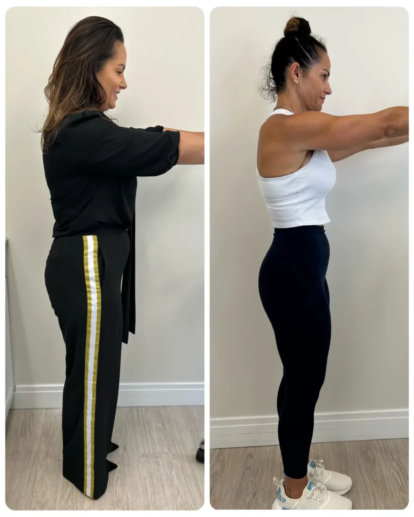 Before and After Image: Weight Management - right-side