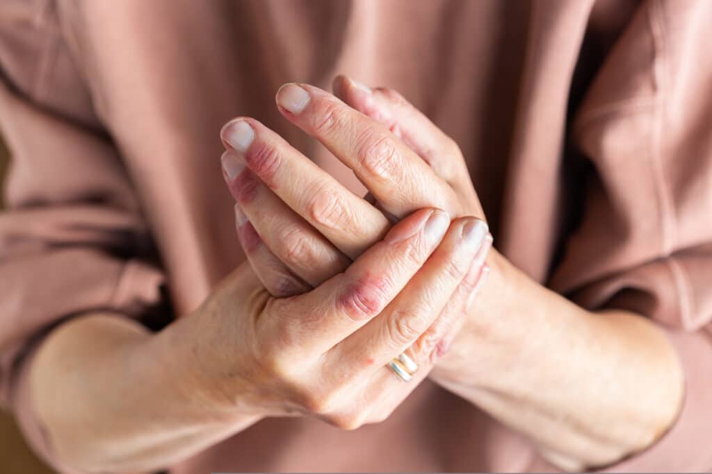 Close-up of an older woman’s hands showing fine lines and visible signs of aging.