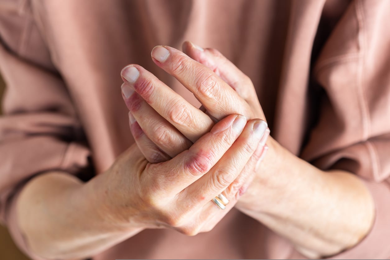 Close-up of an older woman’s hands showing fine lines and visible signs of aging.